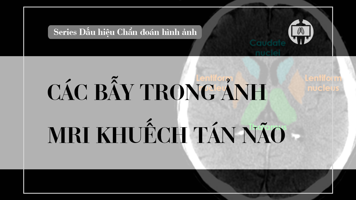 Cac bay trong anh cong huong tu khuech tan nao