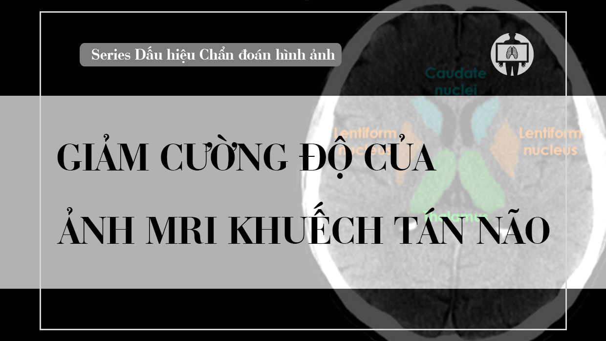 Giam cuong do cua anh MRI khuech tan nao