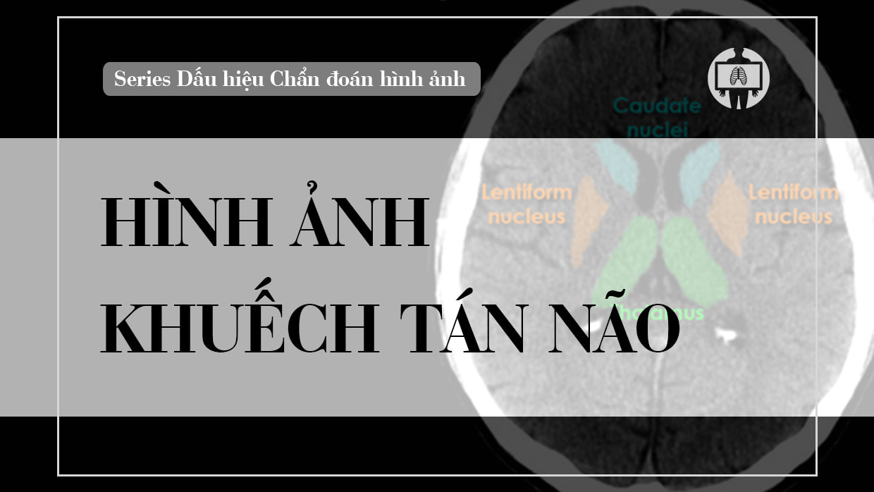 hinh anh khuech tan nao
