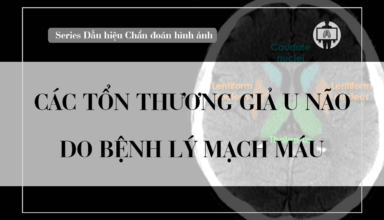 Cac ton thuong gia u nao