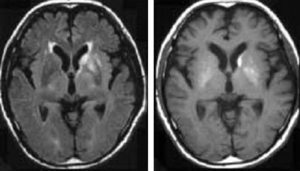 Cac ton thuong gia u nao - hinh 1cd