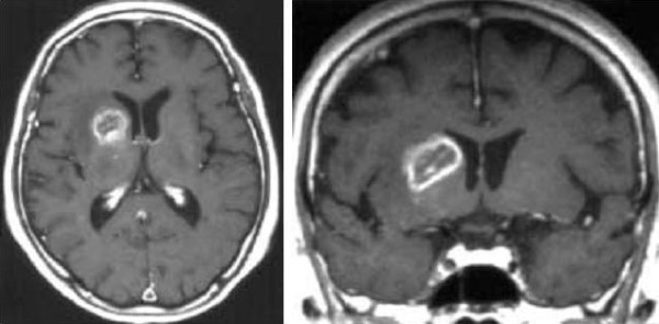 Cac ton thuong gia u nao - hinh 4ab