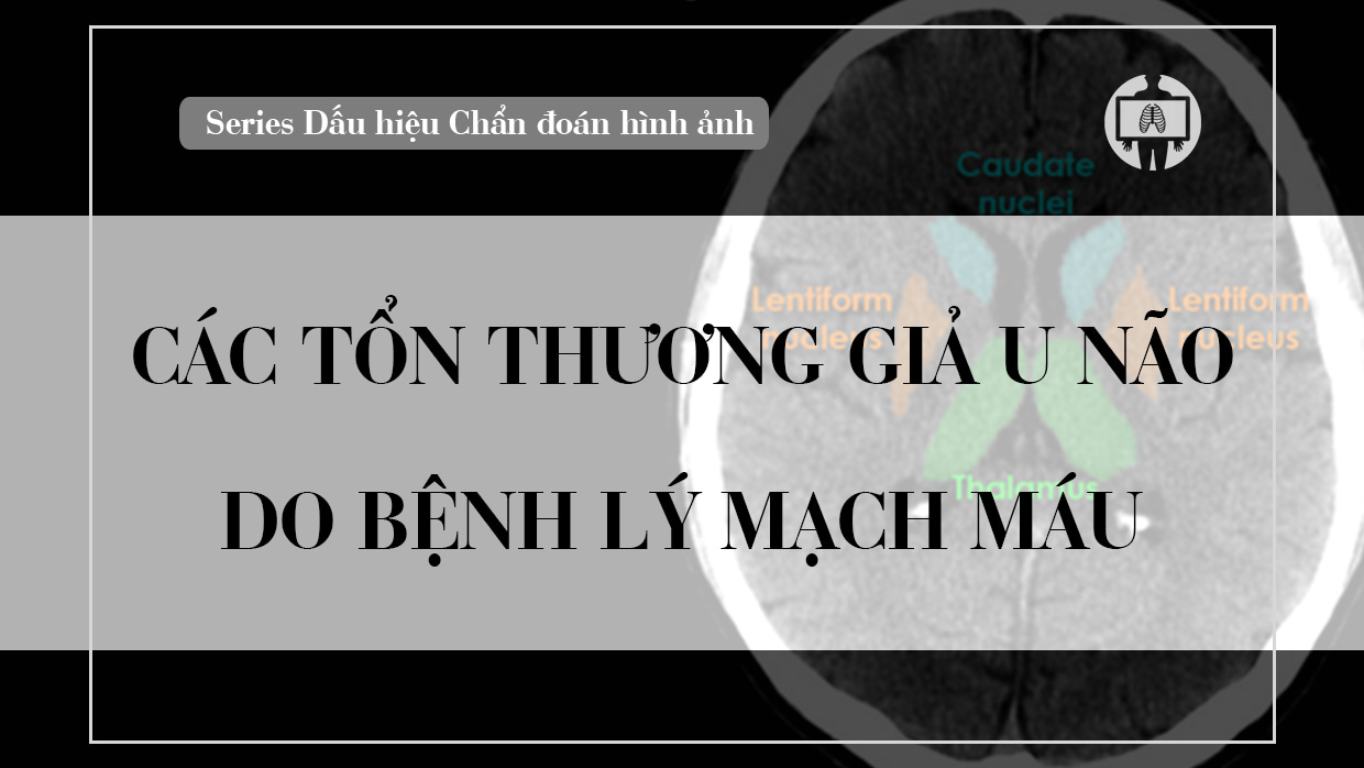 Cac ton thuong gia u nao