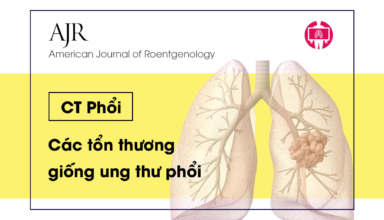 CT Phoi - Cac ton thuong giong ung thu phoi