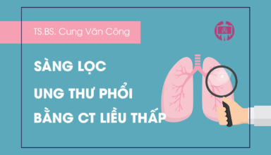 Tong quan sang loc ung thu phoi bang CT lieu thap