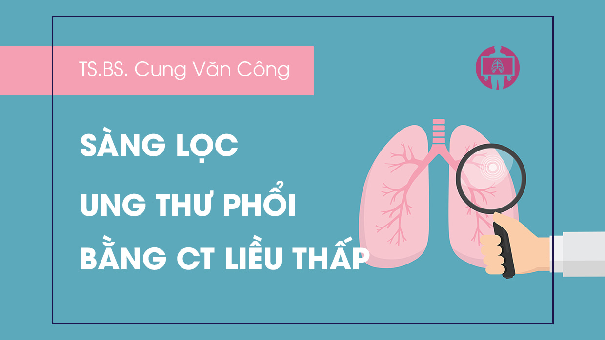 Tong quan sang loc ung thu phoi bang CT lieu thap