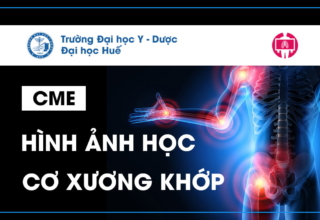 CME Hinh anh hoc co xuong khop
