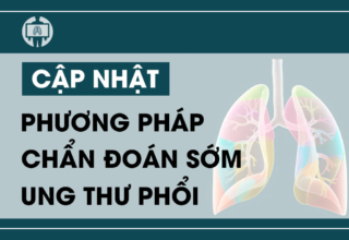 Cap nhat cac phuong phap chan doan som ung thu phoi