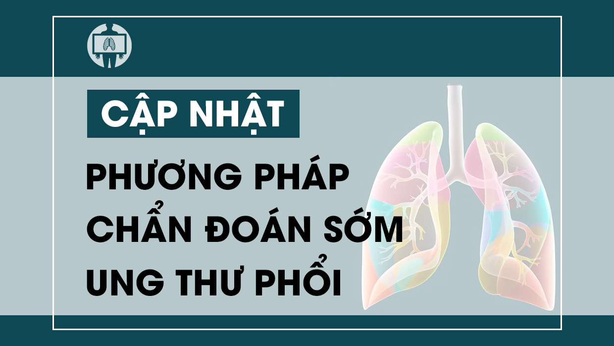 Cap nhat cac phuong phap chan doan som ung thu phoi
