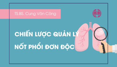 Chien luoc quan ly not phoi don doc