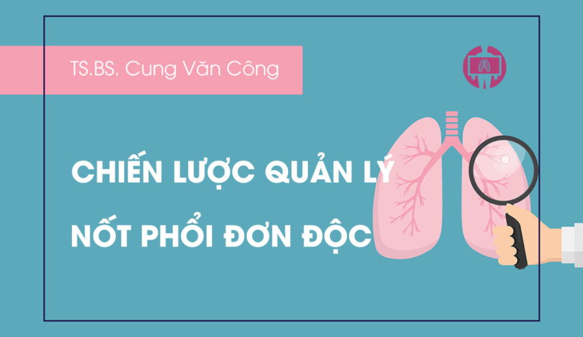 Chien luoc quan ly not phoi don doc