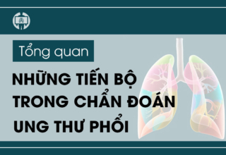 Nhung tien bo trong chan doan ung thu phoi