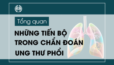 Nhung tien bo trong chan doan ung thu phoi