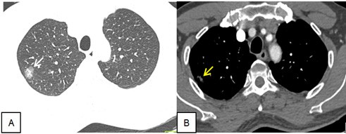 Tong quan Not don doc ban dac ac tinh - Hinh 1