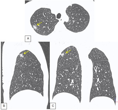 Tong quan Not don doc ban dac ac tinh - Hinh 2