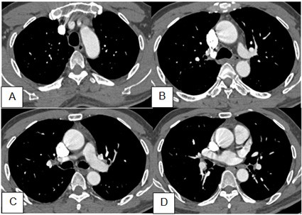 Tong quan Not don doc ban dac ac tinh - Hinh 3