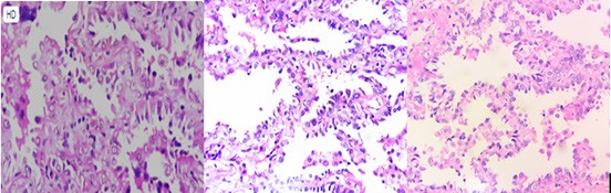 Tong quan Not don doc ban dac ac tinh - Hinh 4