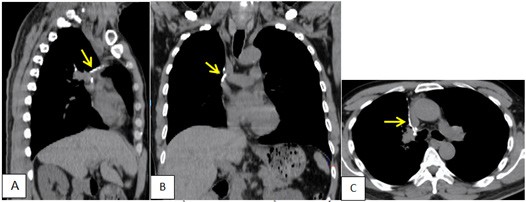 Tong quan Not don doc ban dac ac tinh - Hinh 5