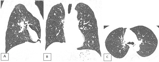 Tong quan Not don doc ban dac ac tinh - Hinh 6