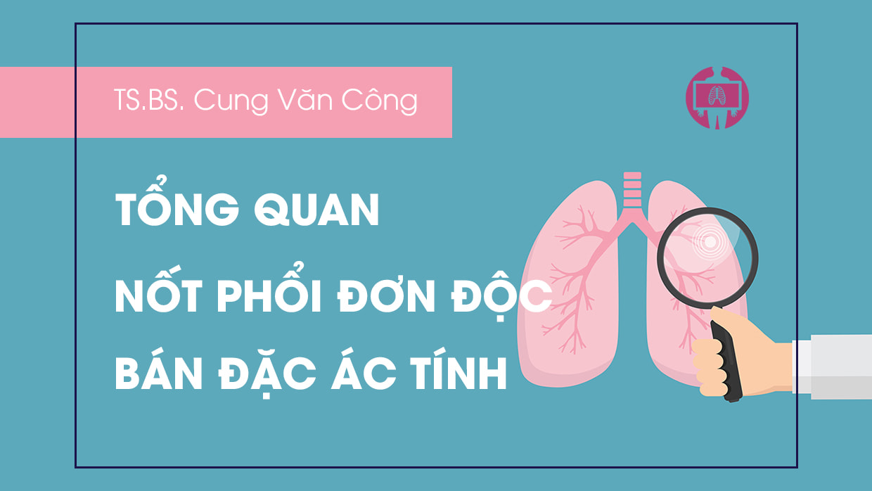Tong quan Not phoi don doc ban dac ac tinh