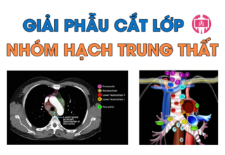 Atlas giai phau cat lop phan nhom hach trung that