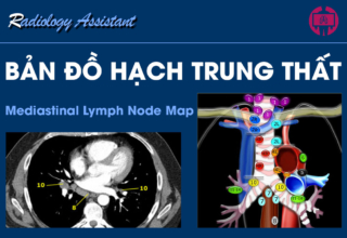 Ban do hach trung that (Mediastinal Lymph Node Map)