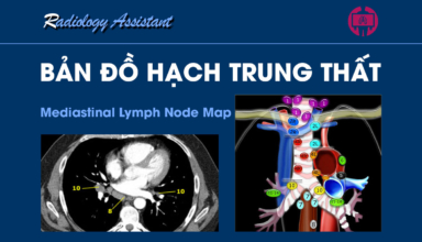 Ban do hach trung that (Mediastinal Lymph Node Map)