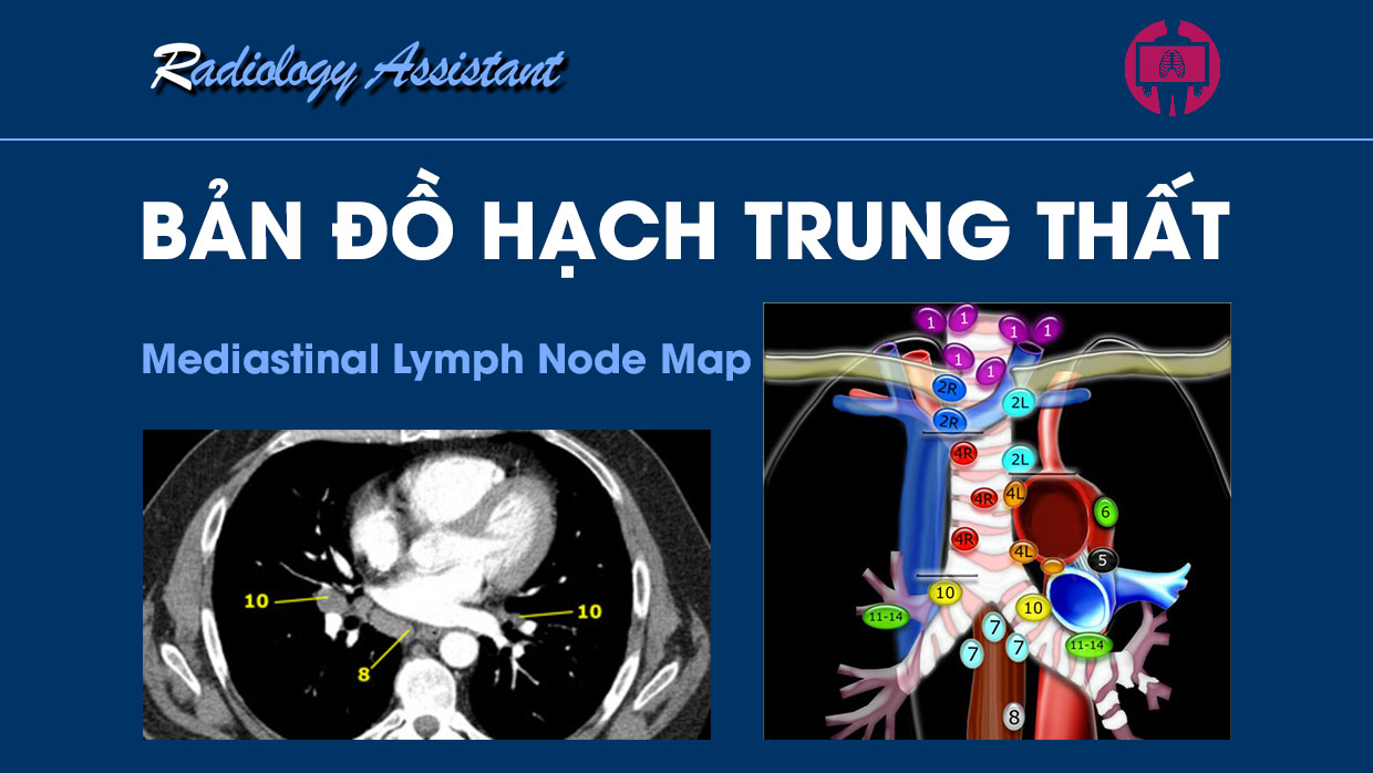 Ban do hach trung that (Mediastinal Lymph Node Map)